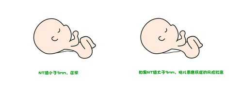 胎儿系统筛查是什么(it检查是什么意思啊) 第1张 胎儿系统筛查是什么(it检查是什么意思啊) 第1张