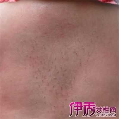 孕期胎毒有哪些症状(孕期胎毒有哪些症状图片) 第2张 孕期胎毒有哪些症状(孕期胎毒有哪些症状图片) 第2张