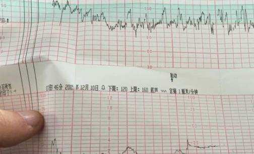 胎儿胎心过慢是什么原因,胎儿心跳慢是什么原因造成的 第2张 胎儿胎心过慢是什么原因,胎儿心跳慢是什么原因造成的 第2张
