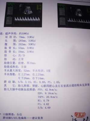 胎儿pi值是什么意思(胎儿pi值是什么意思) 第2张 胎儿pi值是什么意思(胎儿pi值是什么意思) 第2张