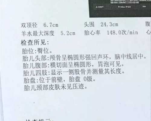 孕期保胎假可以请多久(怀孕职工可以请3个月的保胎假吗) 第1张 孕期保胎假可以请多久(怀孕职工可以请3个月的保胎假吗) 第1张