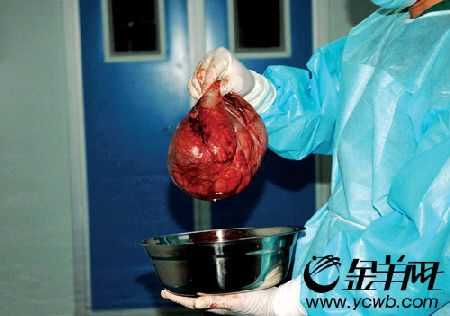 怀孕期间有囊肿(怀孕两个月右附件有个囊肿) 第1张 怀孕期间有囊肿(怀孕两个月右附件有个囊肿) 第1张