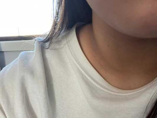 孕妇脖子变黑是怎么回事呢?正常的吗,孕期黑色素沉淀的原因有哪些 第2张 孕妇脖子变黑是怎么回事呢?正常的吗,孕期黑色素沉淀的原因有哪些 第2张