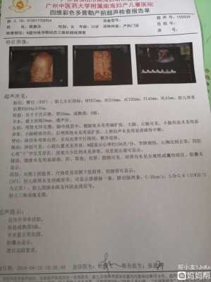 24周胎儿有多大,孕24周胎儿四维彩超正常值  第2张