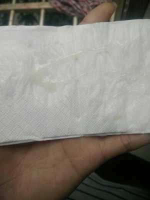 怀孕期间白带多怎么回事 第2张 怀孕期间白带多怎么回事 第2张