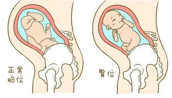 胎儿打嗝的位置（胎儿打嗝的位置是头还是哪个部位）  第2张