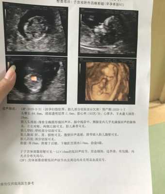 nt和st的区别,孕期英语怎么写 第3张 nt和st的区别,孕期英语怎么写 第3张