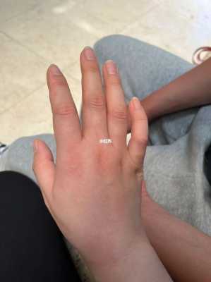 孕期手臂疼(孕期手臂疼) 第2张 孕期手臂疼(孕期手臂疼) 第2张