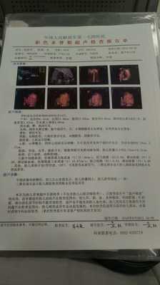 四维彩超心脏有强光点怎么办,24周胎儿左心室强光点怎么办 第1张 四维彩超心脏有强光点怎么办,24周胎儿左心室强光点怎么办 第1张
