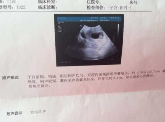 b超看胎儿大小准确吗(为什么B超检查说胎儿比实际孕周大是什么意思) 第2张 b超看胎儿大小准确吗(为什么B超检查说胎儿比实际孕周大是什么意思) 第2张