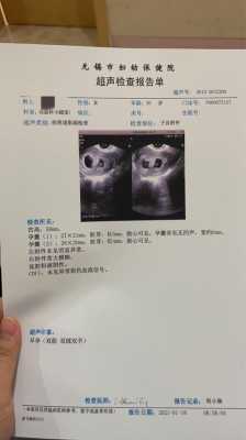 怀孕48天,孕酮17,hcg7万多,怎么办,孕期48天没有胎心胎芽 第3张 怀孕48天,孕酮17,hcg7万多,怎么办,孕期48天没有胎心胎芽 第3张
