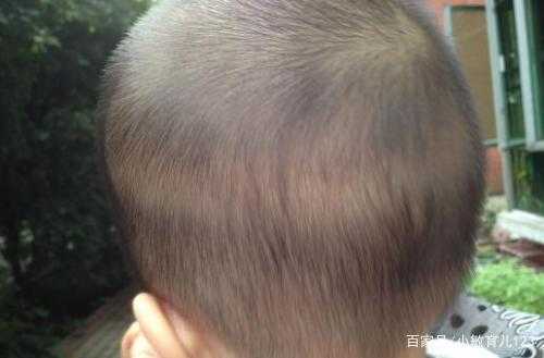 别人夸宝宝头发好要怎么回复,孕妇吃什么胎儿头发好 第3张 别人夸宝宝头发好要怎么回复,孕妇吃什么胎儿头发好 第3张