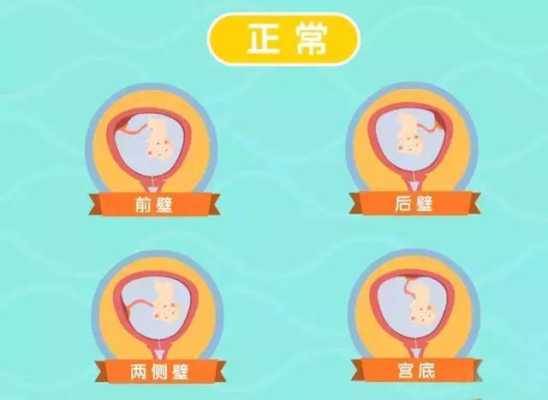 胎儿后壁图(后壁和后位是一个意思吗) 第1张 胎儿后壁图(后壁和后位是一个意思吗) 第1张