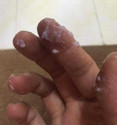 孕妇白带太多怎么办,孕晚期用手抠出一大坨豆腐渣 第3张 孕妇白带太多怎么办,孕晚期用手抠出一大坨豆腐渣 第3张