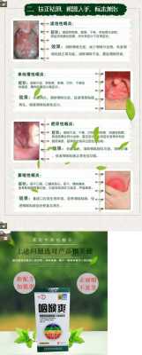 孕期喉咙发炎怎么办,怀孕期间咽炎犯了怎么办  第1张