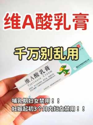 孕期能用药膏吗(孕期能用药膏吗女性) 第1张 孕期能用药膏吗(孕期能用药膏吗女性) 第1张