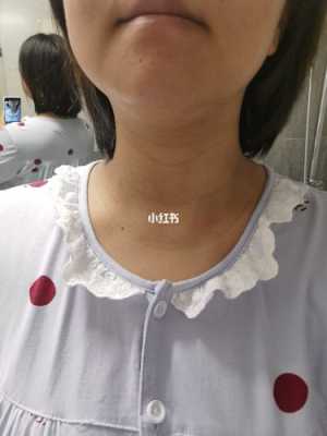 孕期色素沉着多久恢复(孕期色素沉着多久恢复正常) 第3张 孕期色素沉着多久恢复(孕期色素沉着多久恢复正常) 第3张
