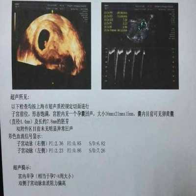 什么造成胎儿没有胎心(什么造成胎儿没有胎心胎芽) 第3张 什么造成胎儿没有胎心(什么造成胎儿没有胎心胎芽) 第3张