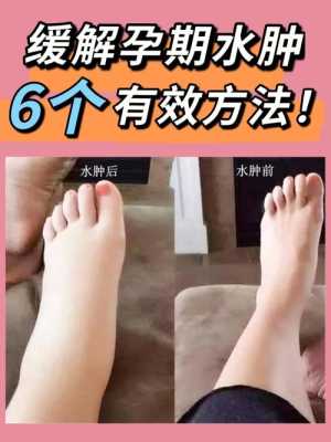 孕妇脚浮肿怎么缓解?怀孕九个多月,水肿很厉害有什么办法能改善,孕期肾水肿怎么办 第2张 孕妇脚浮肿怎么缓解?怀孕九个多月,水肿很厉害有什么办法能改善,孕期肾水肿怎么办 第2张