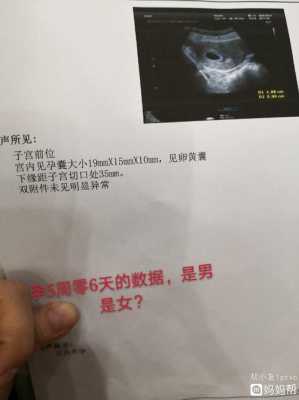请问怀孕41天了,没有孕期反应,正常吗,孕期没反应说明什么 第2张 请问怀孕41天了,没有孕期反应,正常吗,孕期没反应说明什么 第2张