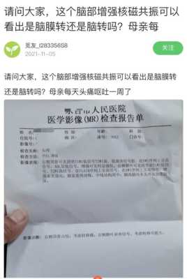 胎儿脑部核磁共振多少钱(胎儿脑部核磁共振多少钱一次) 第1张 胎儿脑部核磁共振多少钱(胎儿脑部核磁共振多少钱一次) 第1张