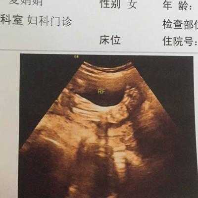 胎儿脚长(胎儿脚长是哪个数据) 第3张 胎儿脚长(胎儿脚长是哪个数据) 第3张