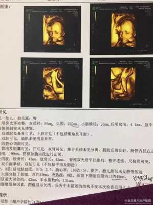胎儿排畸形(胎儿排畸形在多少周) 第3张 胎儿排畸形(胎儿排畸形在多少周) 第3张