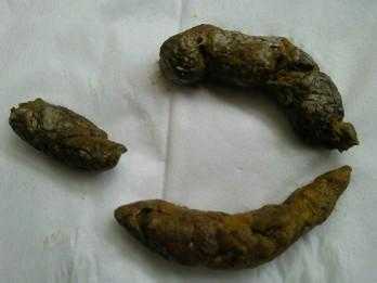 孕期梦到屎(孕期梦到屎是什么意思) 第2张 孕期梦到屎(孕期梦到屎是什么意思) 第2张
