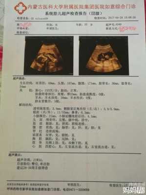 胎儿三级检查(胎儿三级筛查是大排畸吗) 第2张 胎儿三级检查(胎儿三级筛查是大排畸吗) 第2张