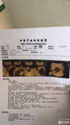 胎儿三级检查(胎儿三级筛查是大排畸吗) 第1张 胎儿三级检查(胎儿三级筛查是大排畸吗) 第1张
