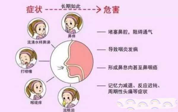 孕妇鼻炎对胎儿的影响(孕妇鼻炎对胎儿的影响大吗) 第1张 孕妇鼻炎对胎儿的影响(孕妇鼻炎对胎儿的影响大吗) 第1张
