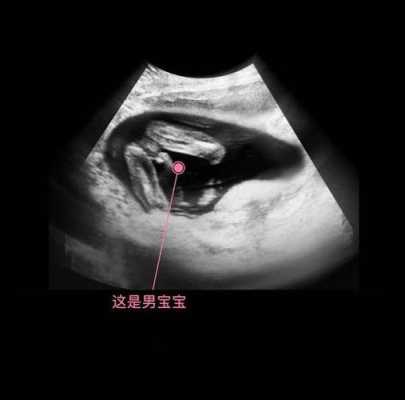 怀孕十七周胎儿有多大(怀孕十七周胎儿有多大才正常) 第3张 怀孕十七周胎儿有多大(怀孕十七周胎儿有多大才正常) 第3张
