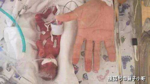 23周胎儿有多大了(亲们,胎儿23周心脏发育好了吗) 第3张 23周胎儿有多大了(亲们,胎儿23周心脏发育好了吗) 第3张