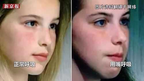 孕期鼻炎对胎儿的影响(孕期鼻炎对胎儿的影响大吗) 第1张 孕期鼻炎对胎儿的影响(孕期鼻炎对胎儿的影响大吗) 第1张