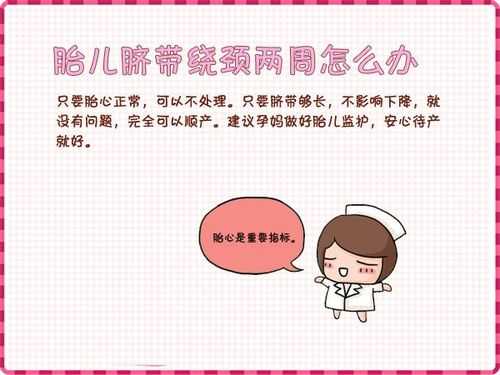 如何防止胎儿脐带绕颈(脐带绕颈和睡姿有关吗) 第2张 如何防止胎儿脐带绕颈(脐带绕颈和睡姿有关吗) 第2张