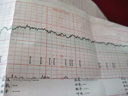 孕33周胎儿缺氧的表现是什么呢?谁知道呢,彩超能看出胎儿缺氧吗 第1张 孕33周胎儿缺氧的表现是什么呢?谁知道呢,彩超能看出胎儿缺氧吗 第1张