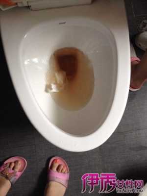 怀孕后发现每次尿尿,气味特别大,什么原因,孕期尿多生女儿吗 第2张 怀孕后发现每次尿尿,气味特别大,什么原因,孕期尿多生女儿吗 第2张