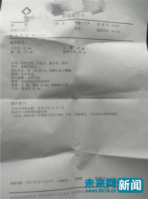 怀孕四个月胎儿彩超图(四维彩超官宣文案) 第3张 怀孕四个月胎儿彩超图(四维彩超官宣文案) 第3张