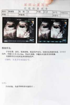 怀孕四个月胎儿彩超图(四维彩超官宣文案) 第2张 怀孕四个月胎儿彩超图(四维彩超官宣文案) 第2张