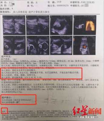 怀孕四个月胎儿彩超图(四维彩超官宣文案) 第1张 怀孕四个月胎儿彩超图(四维彩超官宣文案) 第1张