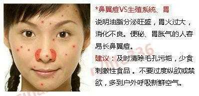 孕期鼻子长痘(孕期鼻子长痘痘是什么原因) 第1张 孕期鼻子长痘(孕期鼻子长痘痘是什么原因) 第1张
