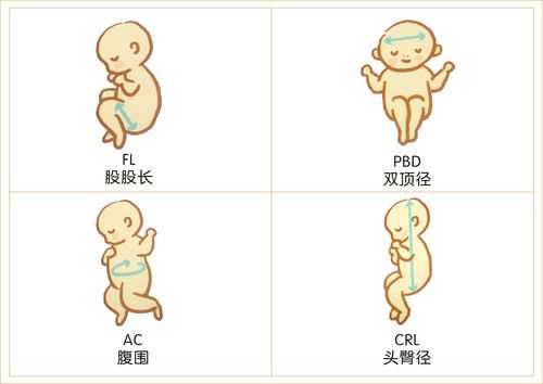 胎儿bdp(bpd是啥意思) 第1张 胎儿bdp(bpd是啥意思) 第1张