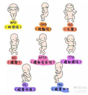 胎儿bdp(bpd是啥意思) 第2张 胎儿bdp(bpd是啥意思) 第2张