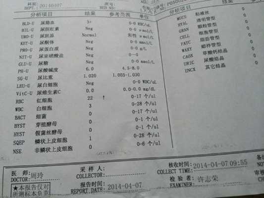 孕期尿隐血3（孕期尿隐血3+）  第1张