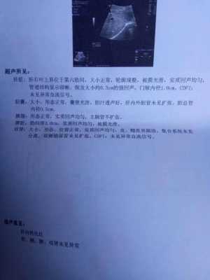 胎儿钙化灶（肝脏有钙化灶是怎么回事）  第2张