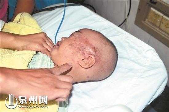 宝宝在宫内挤压左脸变形会好吗,胎儿头挤变形 第1张 宝宝在宫内挤压左脸变形会好吗,胎儿头挤变形 第1张