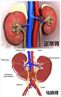 胎儿无右肾(胎儿无右肾是什么原因) 第2张 胎儿无右肾(胎儿无右肾是什么原因) 第2张