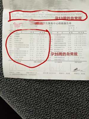 怎么判断胎儿会不会有地中海贫血,检查胎儿地贫做绒毛取样和羊水穿刺哪个便宜一点 第1张 怎么判断胎儿会不会有地中海贫血,检查胎儿地贫做绒毛取样和羊水穿刺哪个便宜一点 第1张