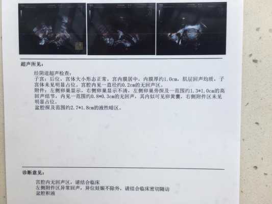 孕期彩超图片(孕期彩超图片怎么看) 第1张 孕期彩超图片(孕期彩超图片怎么看) 第1张