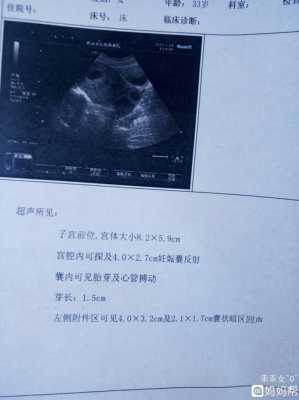 孕期彩超图片(孕期彩超图片怎么看) 第2张 孕期彩超图片(孕期彩超图片怎么看) 第2张